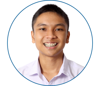 braces in plantation, fl