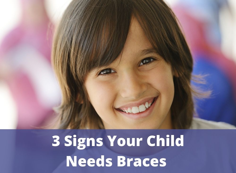 3 Signs Your Child Needs Braces