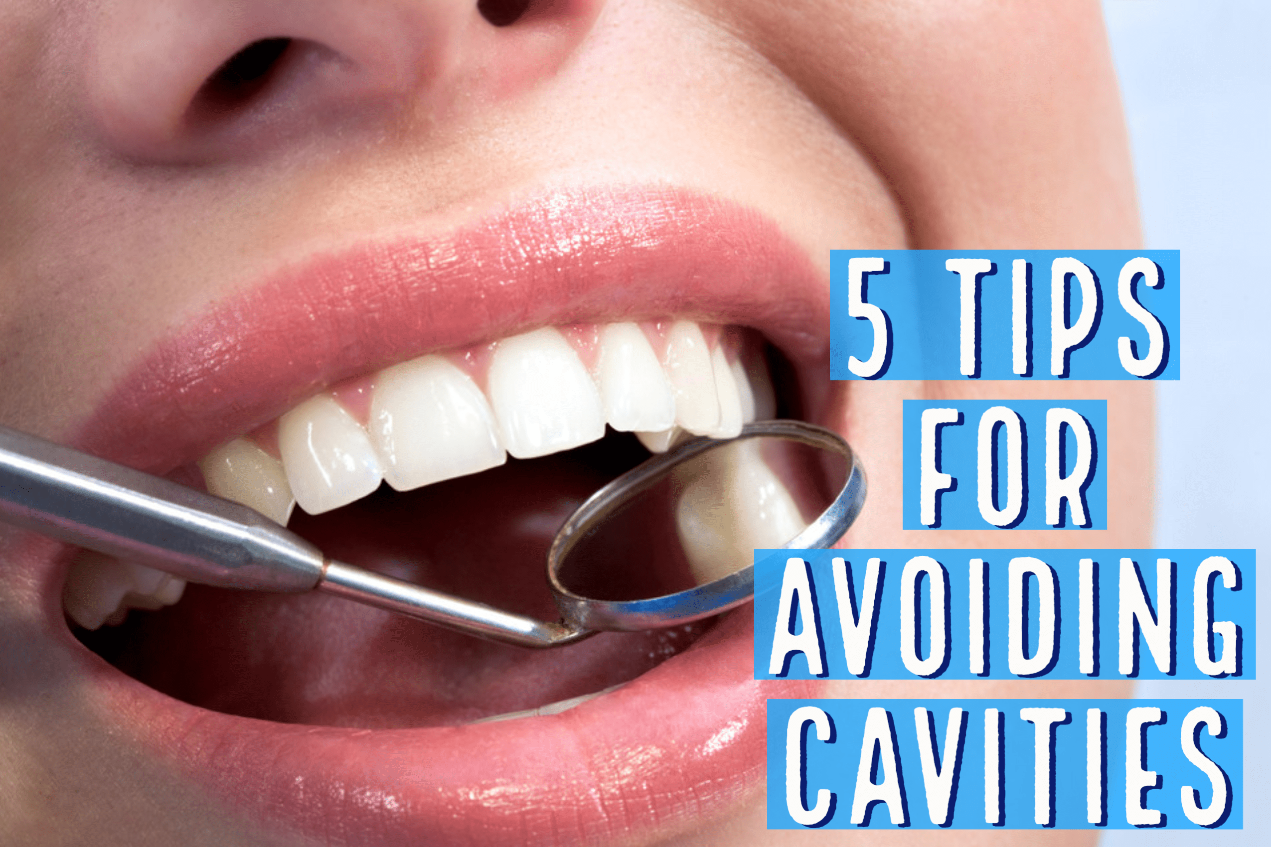 5 Tips For Avoiding Cavities