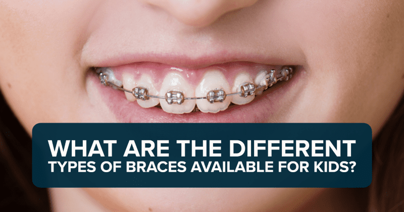 What Are the Different Types of Braces Available for Kids?