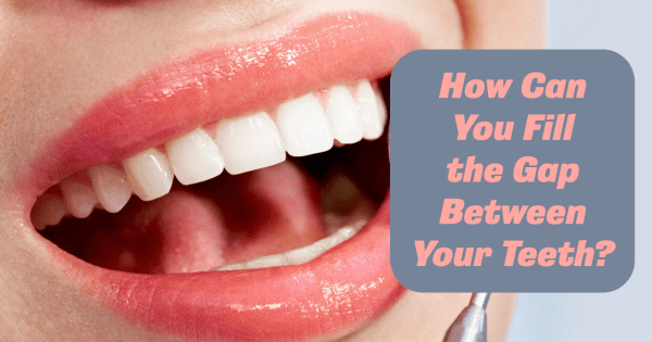 How Can You Fill the Gap Between Your Teeth?
