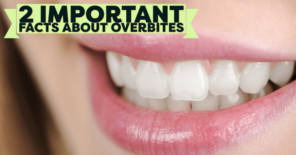 2 Important Facts About Overbites