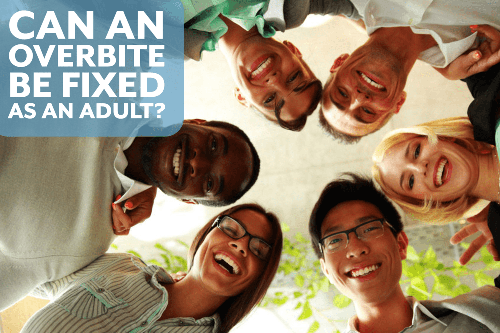 Can an Overbite Be Fixed as an Adult?