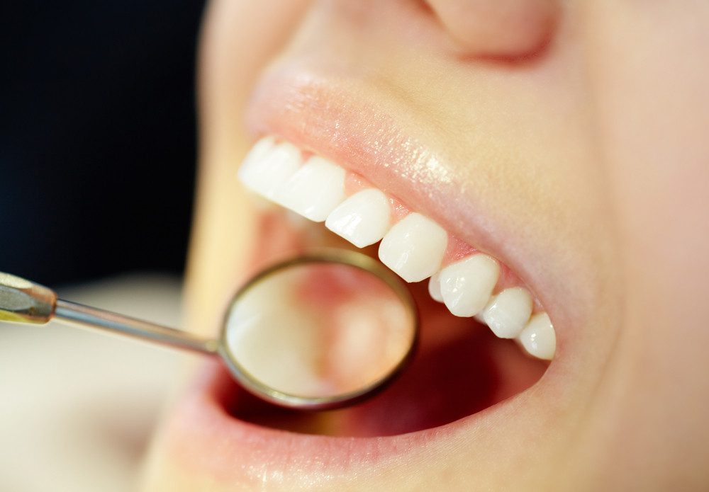 How to Properly Clean Your Retainer
