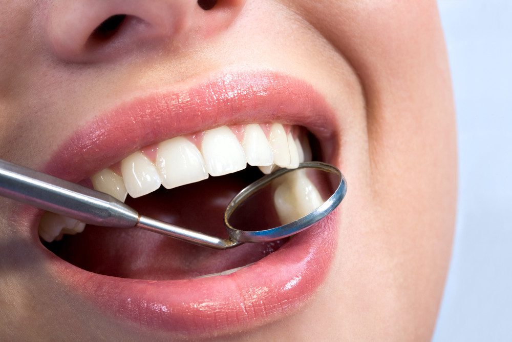 Could You Benefit From Invisalign?