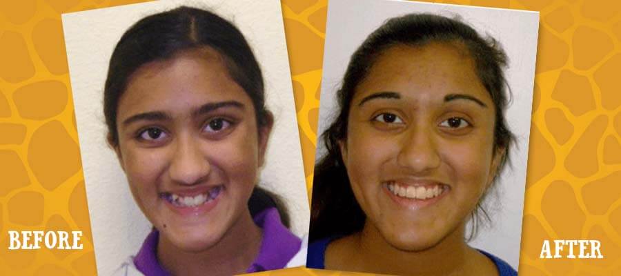 Orthodontic care for kids and teens